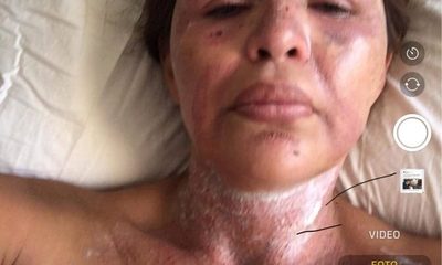 Politica a la que estética “desfiguró” denunciará hecho en la fiscalía: “Soy la única candidata que todavía no tiene afiche”