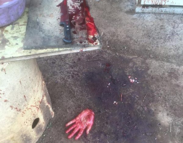 Hombre se corta la mano con cuchillo