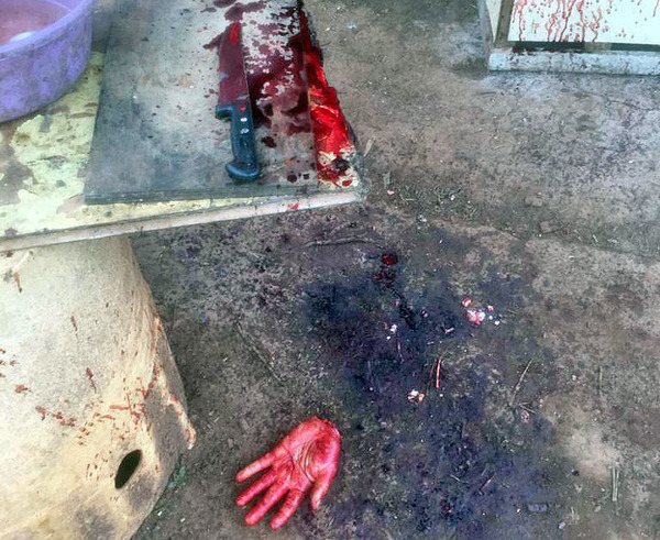 En ritual exorcista un sujeto se amputó la mano izquierda con un cuchillo de mesa