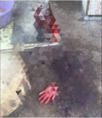 En “autoexorcismo” un hombre se arrancó la mano con un cuchillo