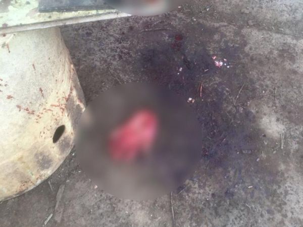 Joven se amputó la mano con un cuchillo