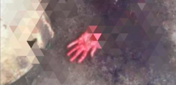 Hombre se amputó la mano con un cuchillo - Noticiero Paraguay