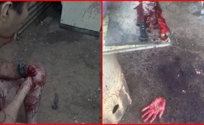 Hombre que practica rituales satánicos se cortó una de las manos