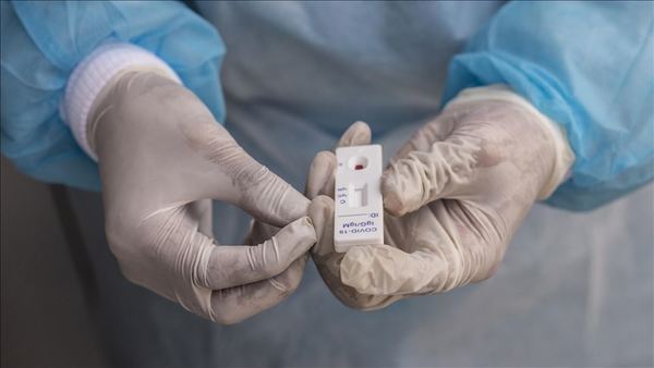 Salud confirma 18 muertos y 1.114 contagiados por coronavirus