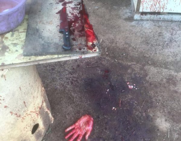 Joven con problema mental se automutiló la mano izquierda – Diario TNPRESS