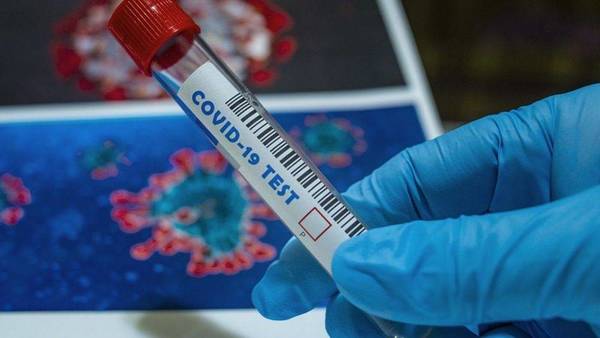 Covid-19: Salud confirma 1.114 nuevos contagios junto a 18 fallecidos