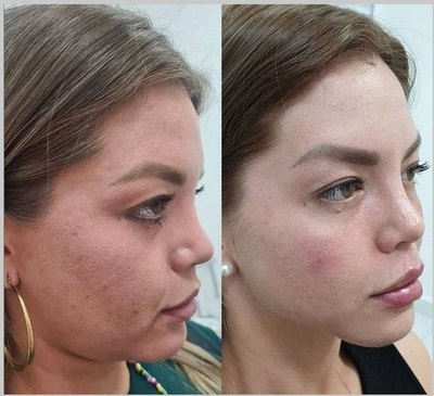 Crónica / “Las misses también somos mujeres reales y humanas”
