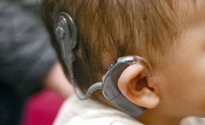Diario HOY | Unos 35 niños con hipoacusia esperan un implante coclear en Clínicas