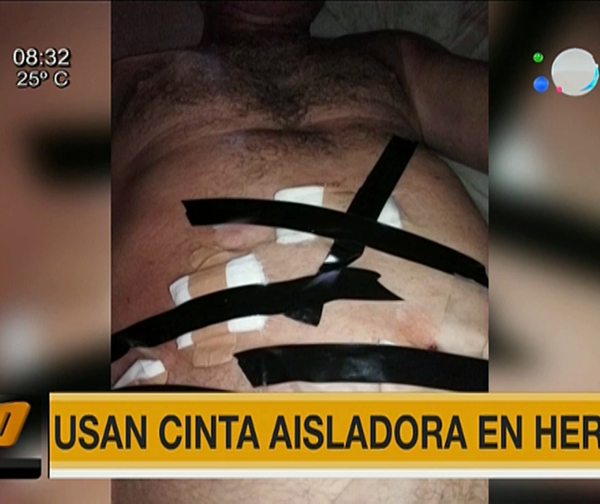 Indignante: Usan cinta aisladora en herido