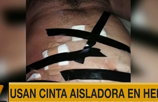 Uso de cinta aisladora en paciente es montaje, según Salud