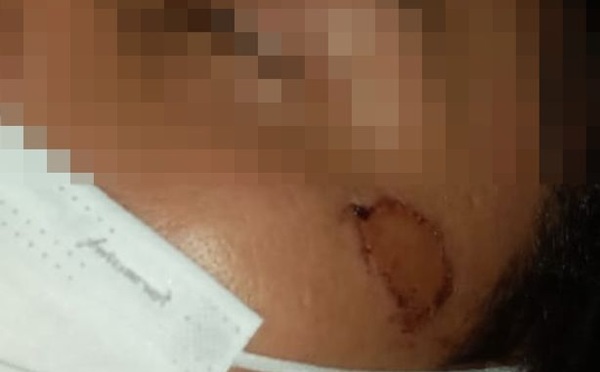 Jefe del Grupo Lince niega tortura a exconvicto que falleció el sábado - Noticiero Paraguay
