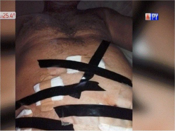 Ministerio de Salud afirma que paciente con cinta aisladora es un montaje