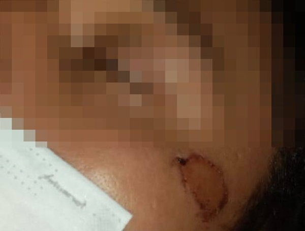 Diario HOY | Ordenan exhumación y autopsia de joven detenido por Grupo Lince