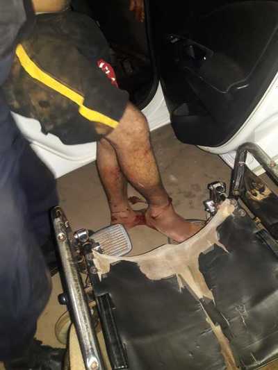 Hombre se disloca el tobillo al tratar de escapar de la Policía
