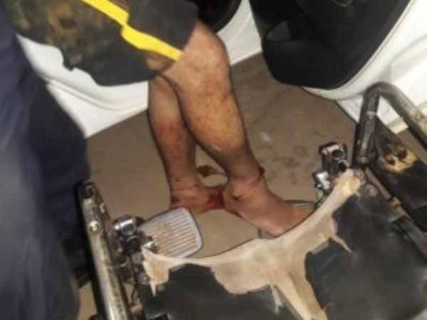 Corrió de la policía, pero se dislocó el tobillo