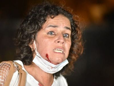 Cinco ciudadanos fueron atendidos en el Hospital de Trauma por heridas