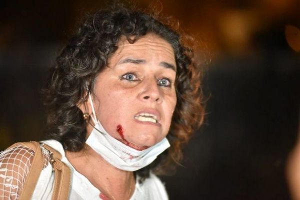 Cinco ciudadanos fueron atendidos en el Hospital de Trauma por heridas