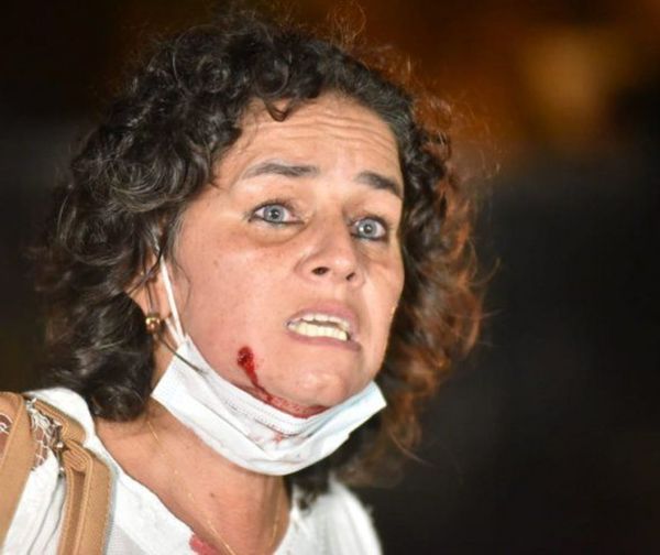 El testimonio de una manifestante herida