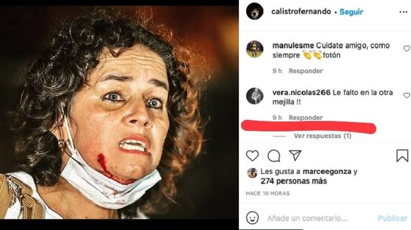 Policía a manifestante herida: “Le faltó otro (balín de goma)” | Noticias Paraguay