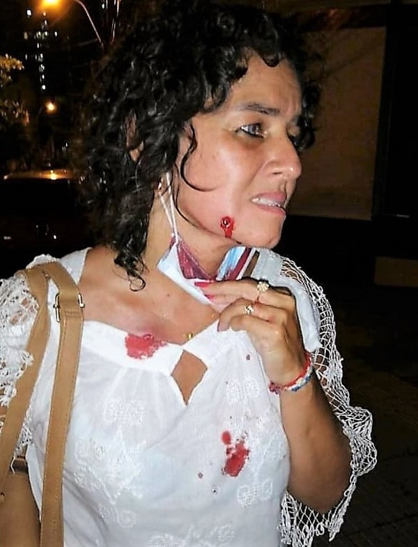 Condenan la “absolutamente desproporcionada represión policial” y exigen la salida de Marito y Velázquez - La Mira Digital
