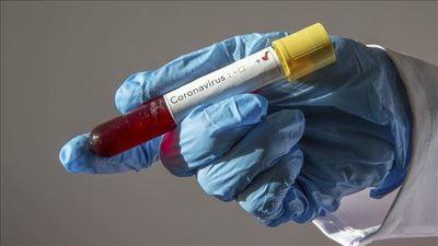 Coronavirus deja 24 finados, 1.074 contagiados y 1.177 internados
