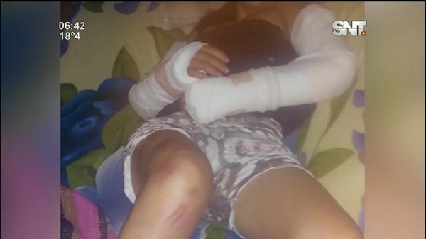Villa Ygatimi: Brutal agresión a una mujer - SNT