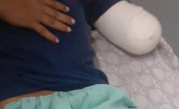 Joven es abandonado sin su antebrazo en un hospital