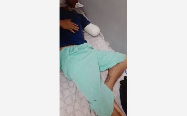 Le cortaron la mano y no recuerda como