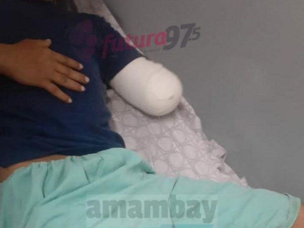Perdió el antebrazo y no recuerda qué le pasó