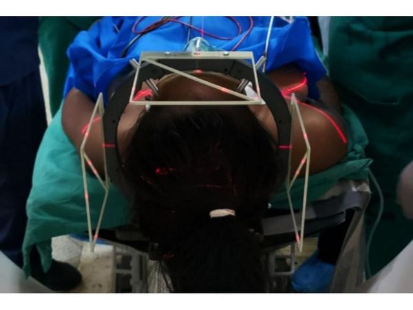 Primera innovadora neurocirugía a gestante en Clínicas