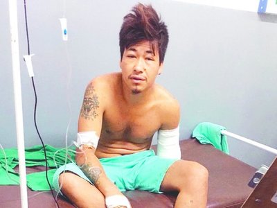 ¿Qué pasó ayer? "Tomé mucho, no sé  cómo perdí el brazo"