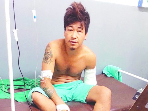 ¿Qué pasó ayer? "Tomé mucho, no sé  cómo perdí el brazo"