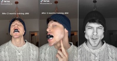 La extrema transformación del rostro de un modelo tras años de ejercicios con la mandíbula: “Parece una ardilla” - C9N
