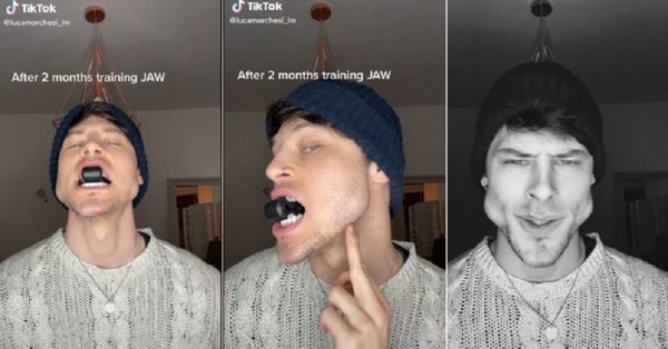 La extrema transformación del rostro de un modelo tras años de ejercicios con la mandíbula: “Parece una ardilla” - C9N