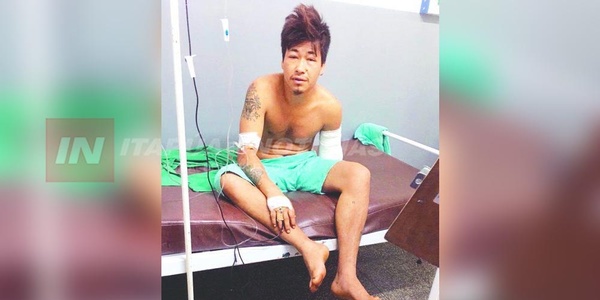 SALIÓ A FARREAR, SE EMBORRACHÓ Y DESPERTÓ CON UN BRAZO CORTADO