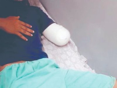 Amputado en frontera salió del hospital sin dejar rastros