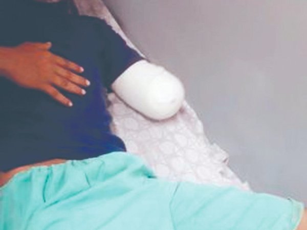 Amputado en frontera salió del hospital sin dejar rastros
