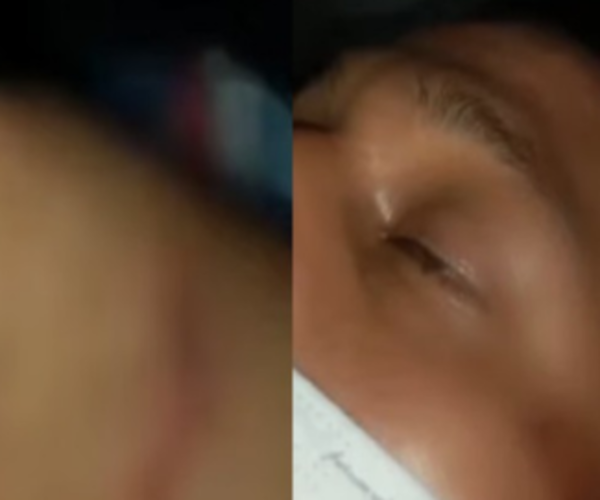 Joven detenido habría fallecido por shock hipovolémico tras fuerte golpe en el abdomen, dice fiscal | Ñanduti