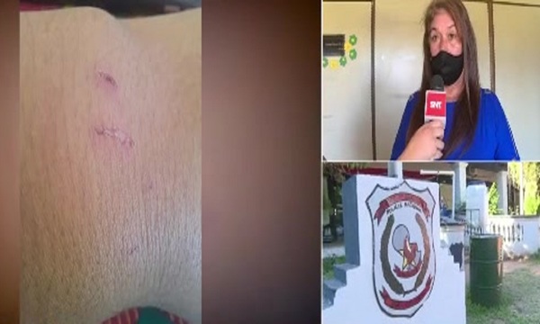 Raptan y agreden a adolescente de 17 años en Caacupé - SNT