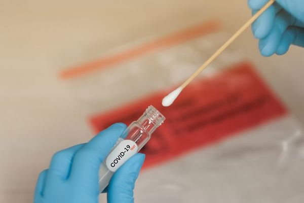¿Para qué sirven los análisis de covid y cuánto cuestan hoy día? - Nacionales - ABC Color