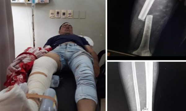 Chocaron a trabajador y le abandonaron a su suerte