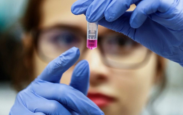 Coronavirus: ¿por qué las mujeres tienen más efectos secundarios con la vacuna? | OnLivePy