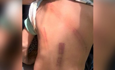 Golpeó a su hija de 10 años con un palo y la echó de la casa