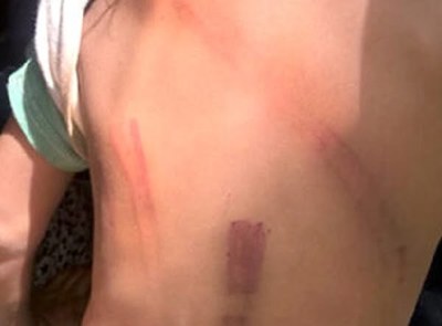 Madre golpeó brutalmente con un palo a su hija de 10 años y la echó de casa - Noticiero Paraguay
