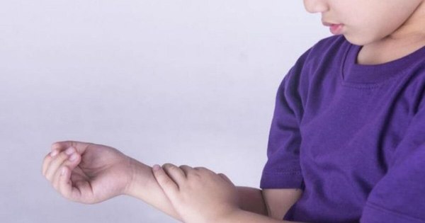 La Nación / Alrededor de 800 niños son atendidos al año por enfermedades reumáticas