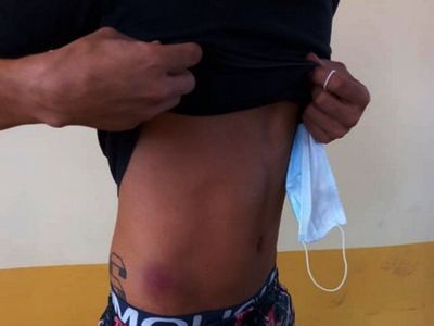 Fiscalía de DDHH investiga abuso policial a manifestantes
