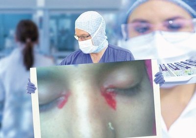 Crónica / Una mujer llora ndaje ¡lagrimitas de sangre!
