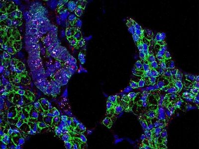El coronavirus también puede infectar las células de la boca
