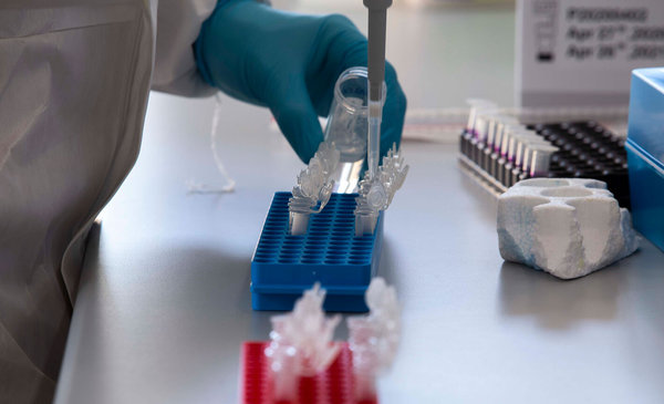 Farmacéutica Biotec niega provisión de insumos contaminados a Salud