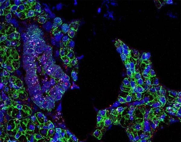 Diario HOY | Descubren cómo el coronavirus también puede infectar las células de la boca